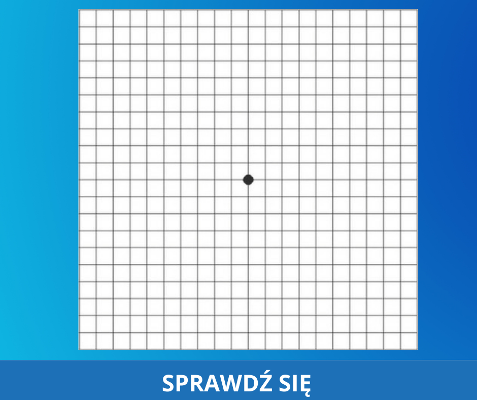 testna AMD